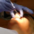 Northcote Dentist: Dr Mark Baker